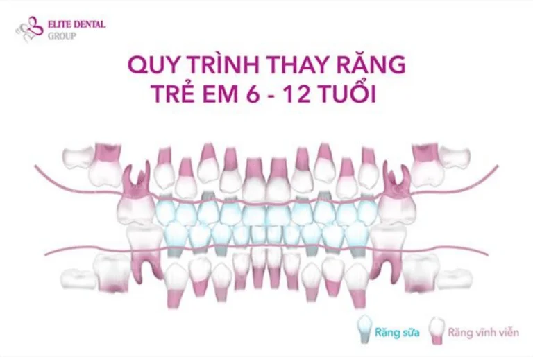 quy-trinh-thay-rang-tre-em-6-12-tuoi
