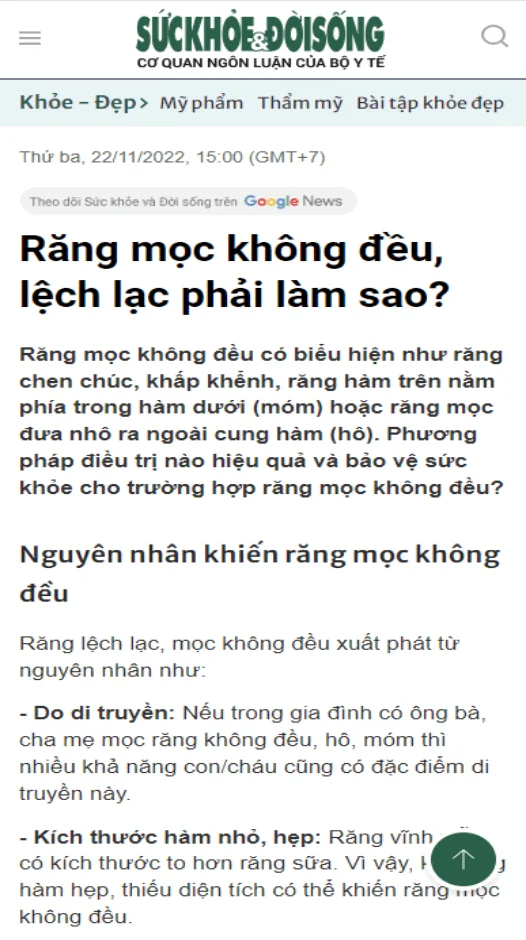 suckhoedoisong-rang-moc-khong-deu-lech-lac-phai-lam-sao